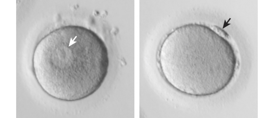 Pictured: examples of the human oocyte stages used in this study. On the left is an immature GV-stage oocyte and on the right the equivalent of mature eggs.